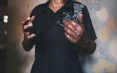 UN rights expert calls on Bangladesh to draft anti-discrimination leprosy laws | UN News – Global perspective Human stories
